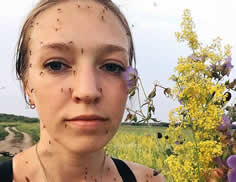 自拍满脸蚊子照 俄罗斯女孩走红
