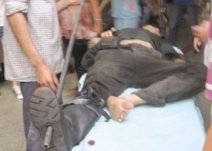 温州一工人右脚被钢管刺穿