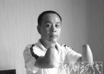 河南举报人被嫌疑犯砍断双手