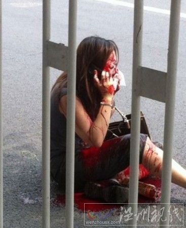 央视网女员工遭“割鼻”案告破 嫌犯被捕