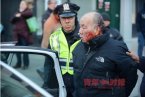 84岁老人头上被纽约警察打出血 美国人都是这么对老