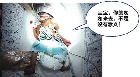 中国最小早产婴离世