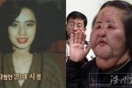 韩国电风扇大妈整容失败不忍直视 整容前是个美女