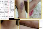 金贤重家暴女友是真的吗 金贤重女友受虐照片