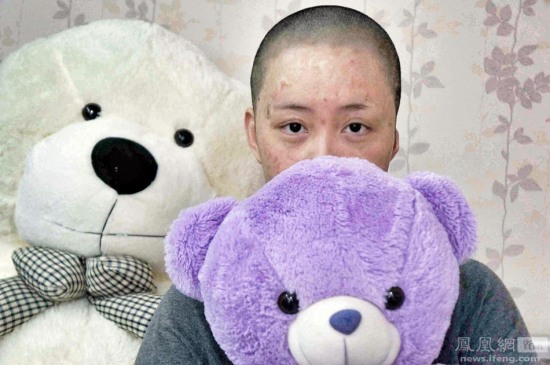 遭官二代毁容少女周岩