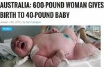 女子诞下18公斤巨婴 打破世界记录