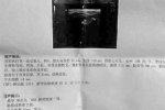 宿州1岁男童被诊怀孕 医院犯低级错误