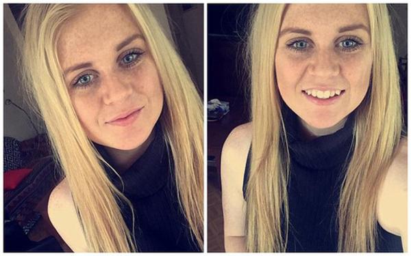 罕见疾病睡10天