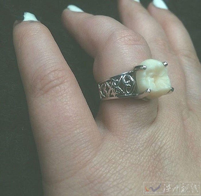 智齿做成的戒指