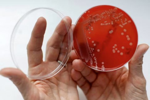 新型抗生素在试验中可有效对抗致命的葡萄球菌感染