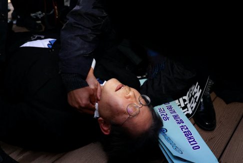 韩国反对派领导人遭袭击被送往重症监护室